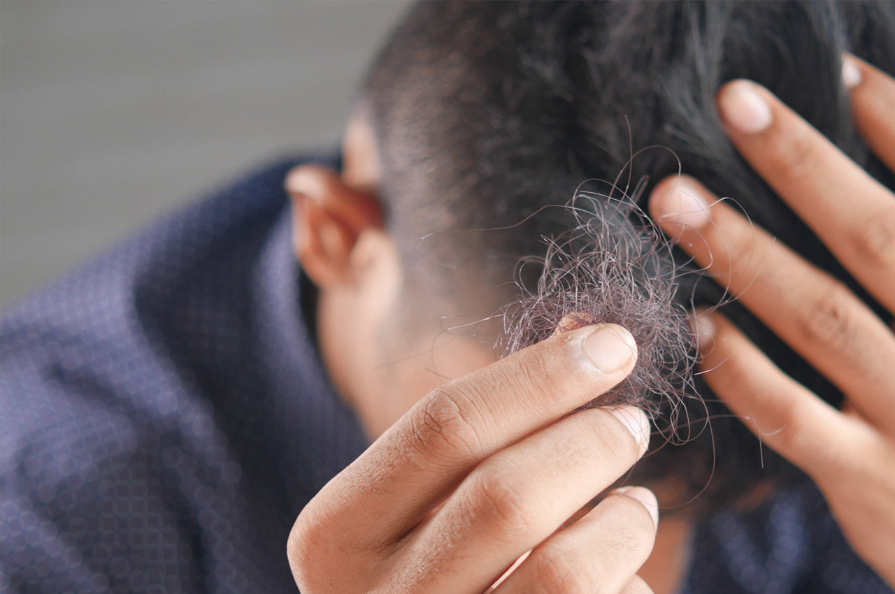 Testosterone And Hair Loss Testosterone And Hair Loss