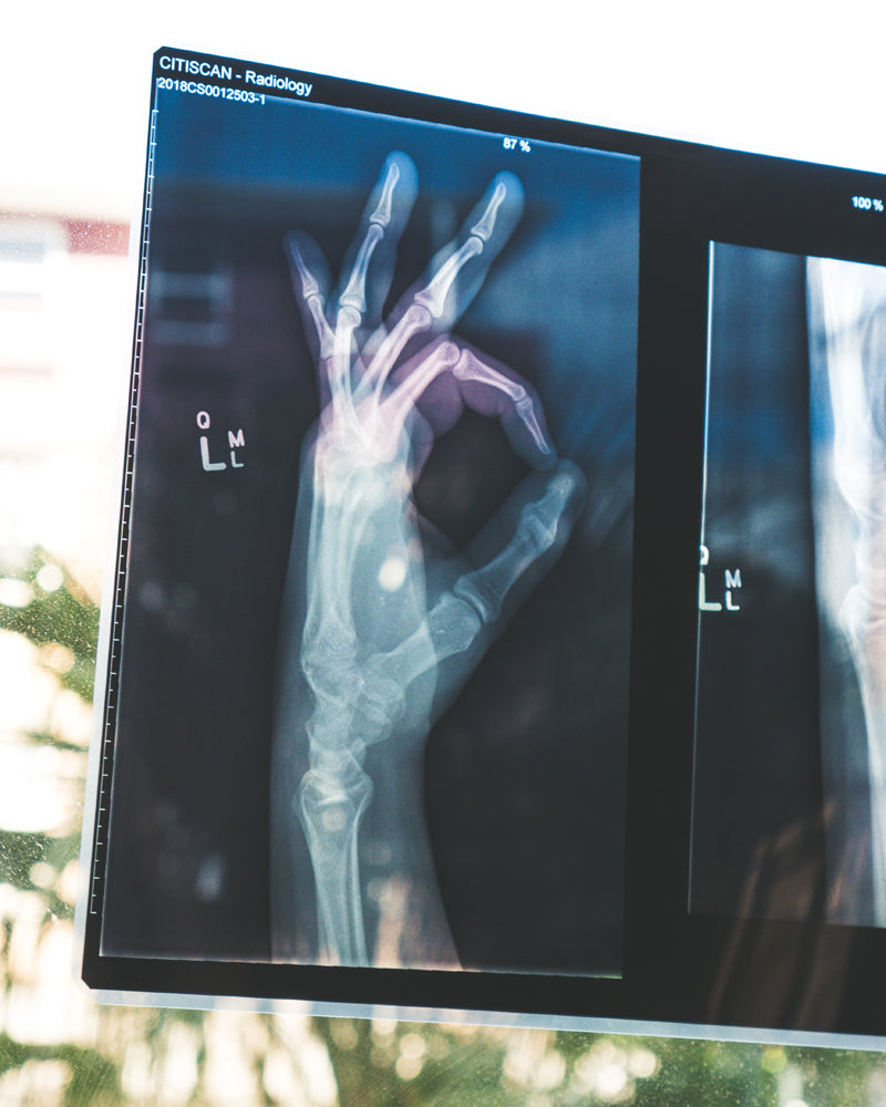 X-Ray